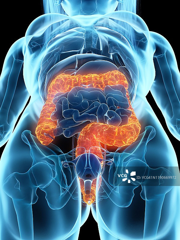 患病结肠插图图片素材