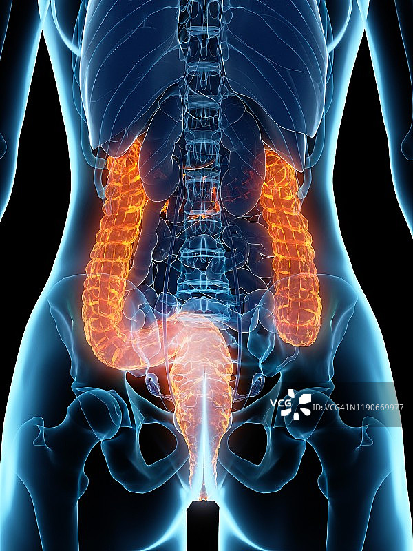 患病结肠插图图片素材