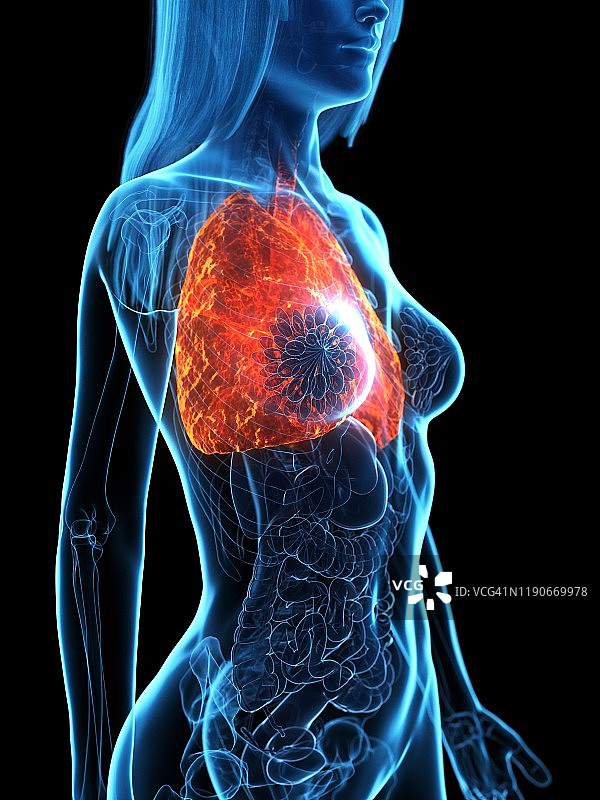 病变的肺部插图图片素材