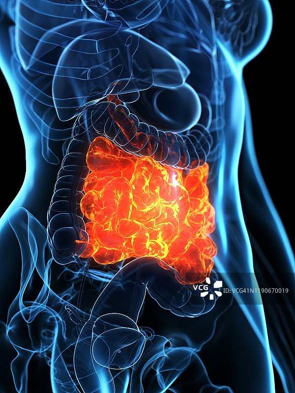 患病的小肠插图图片素材
