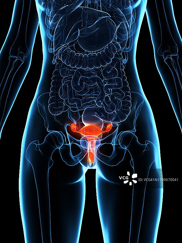 病变子宫插画图片素材