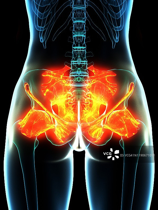 发炎的韧带概念图图片素材