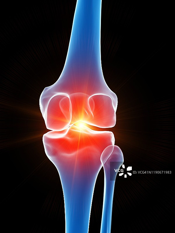 膝盖疼痛概念图图片素材