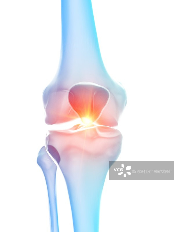 膝盖疼痛概念图图片素材