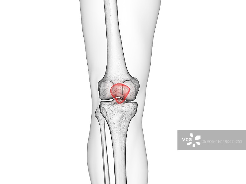 髌骨图示图片素材