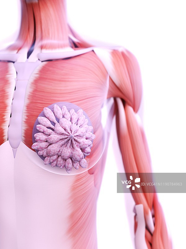 隆胸植入物插图图片素材