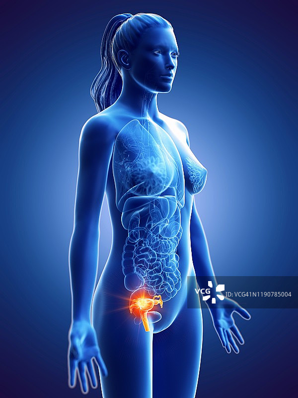 子宫癌概念图图片素材