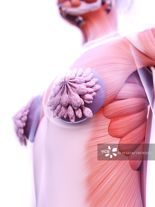 隆胸植入物插图图片素材