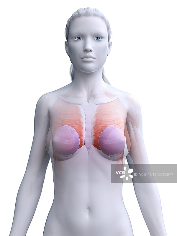 隆胸植入物插图图片素材