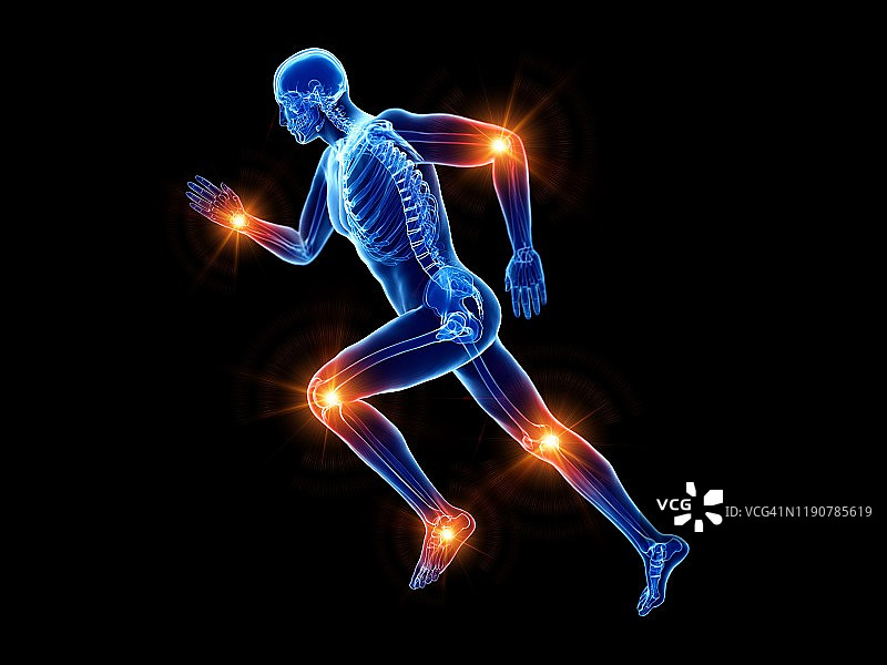 跑步者关节疼痛，概念插画图片素材