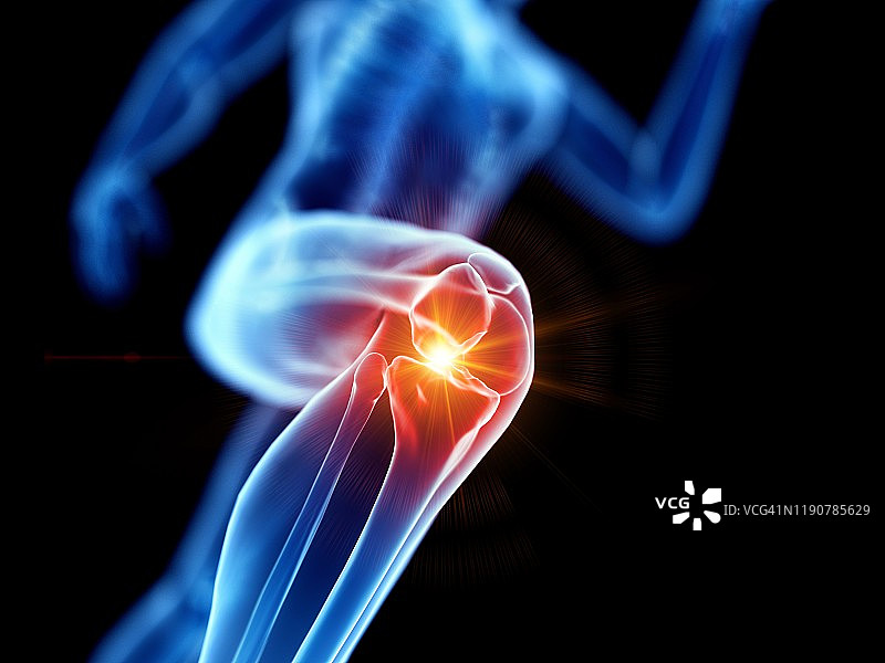 膝盖疼痛的跑步者概念插画图片素材