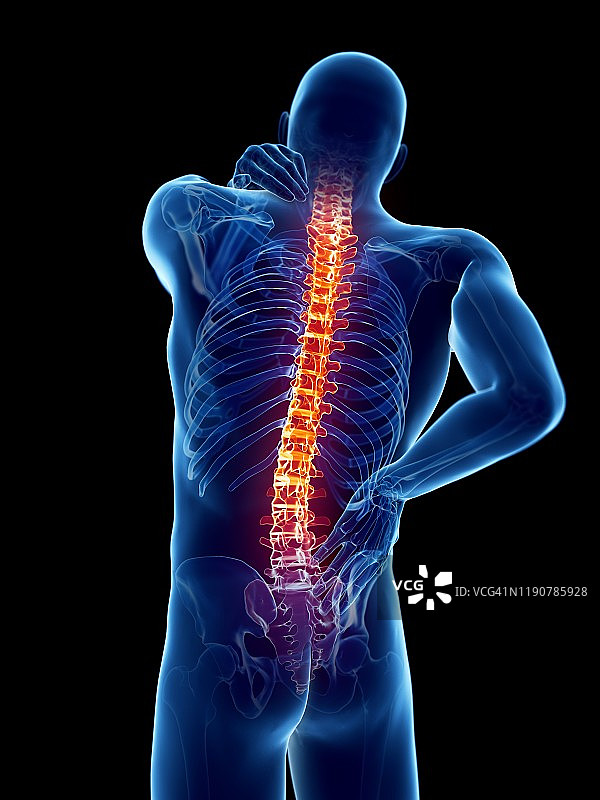 背部疼痛，概念说明图片素材