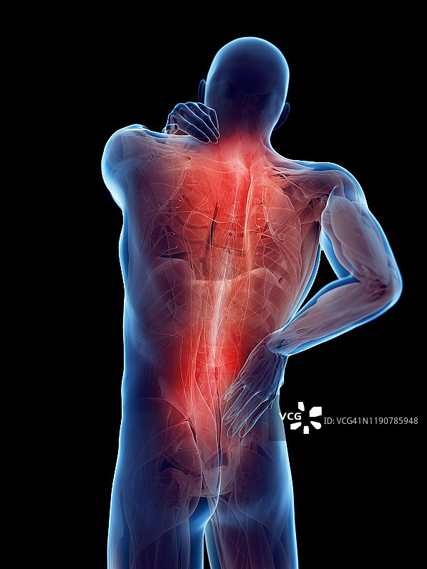 背部疼痛，概念说明图片素材