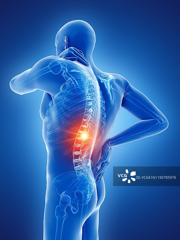 背部疼痛，概念说明图片素材