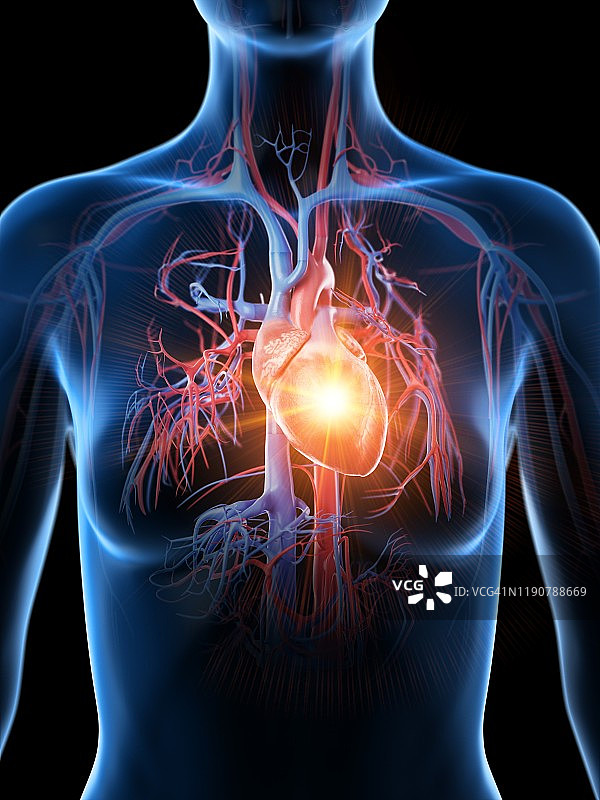 心脏病发作概念插图图片素材