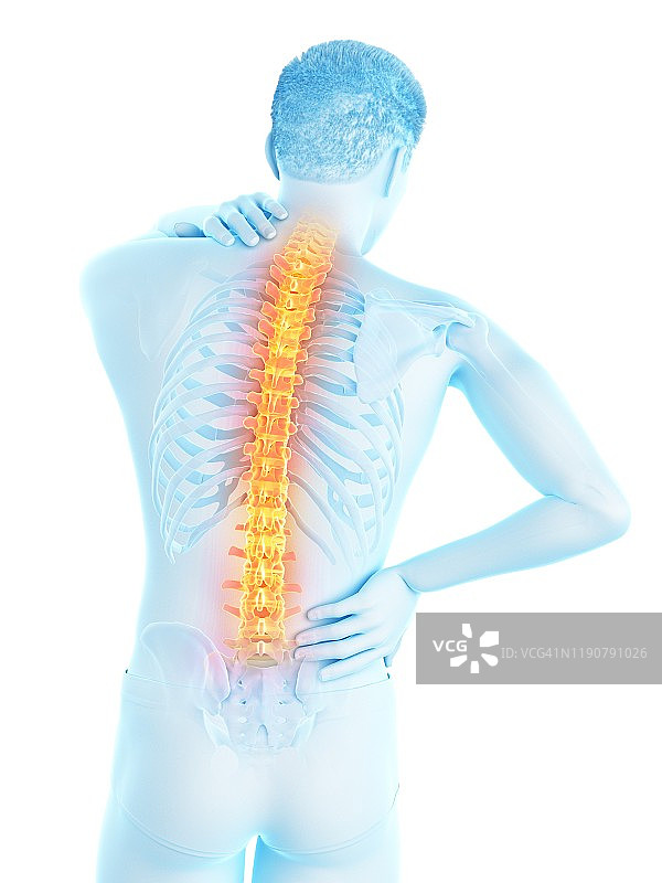 背部疼痛，概念说明图片素材