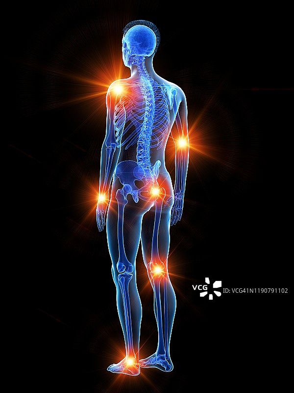 关节疼痛概念图图片素材