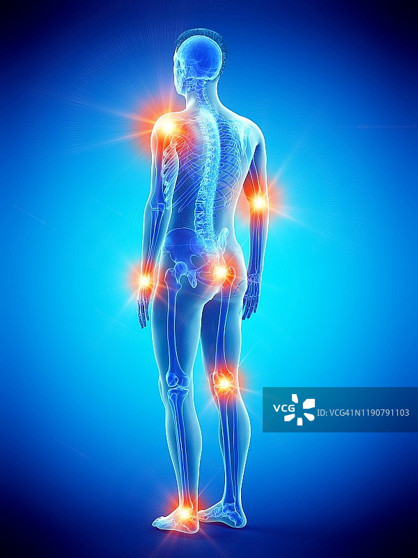 关节疼痛概念图图片素材