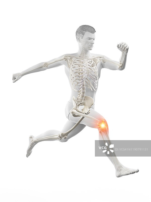 膝盖疼痛的跑步者概念插画图片素材