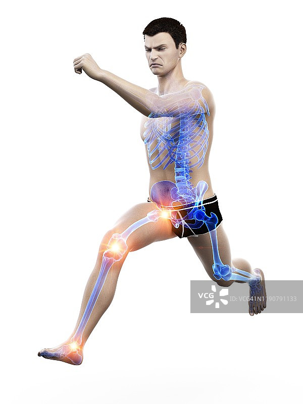 跑步者关节疼痛，概念插画图片素材