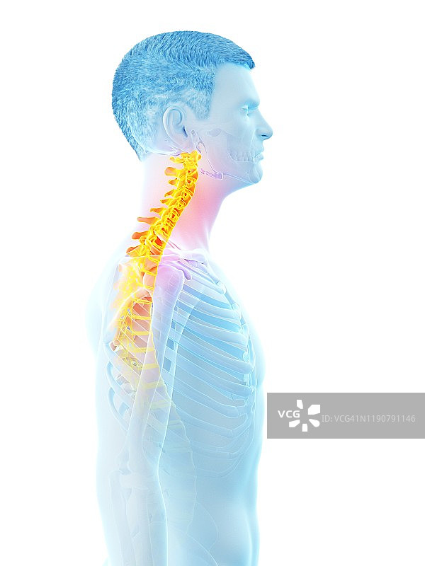 颈部疼痛概念图图片素材