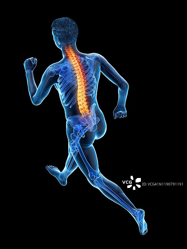 背痛的跑步者概念插图图片素材