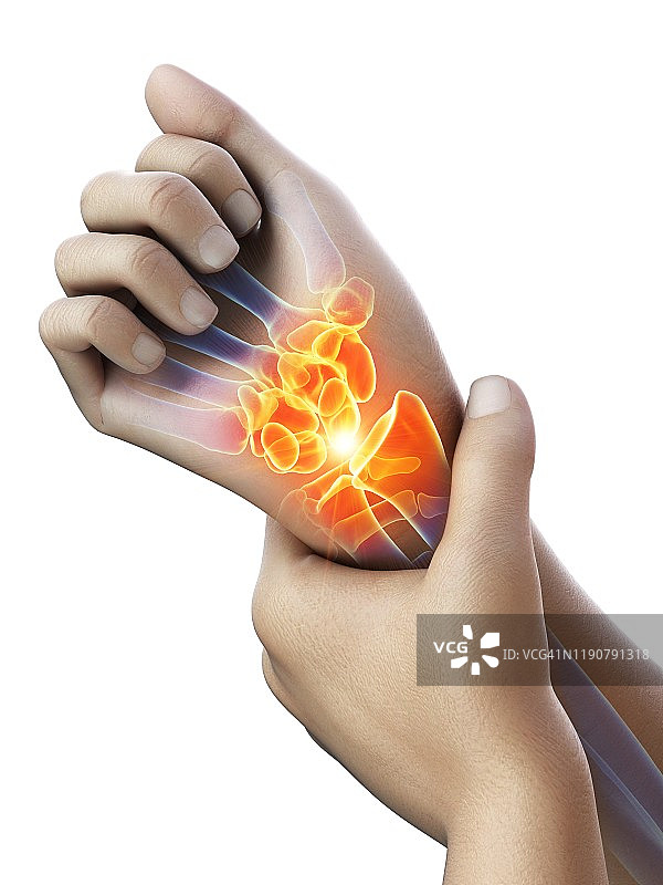 手腕疼痛概念图图片素材