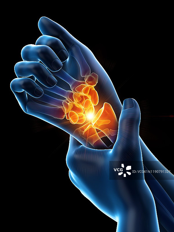 手腕疼痛概念图图片素材