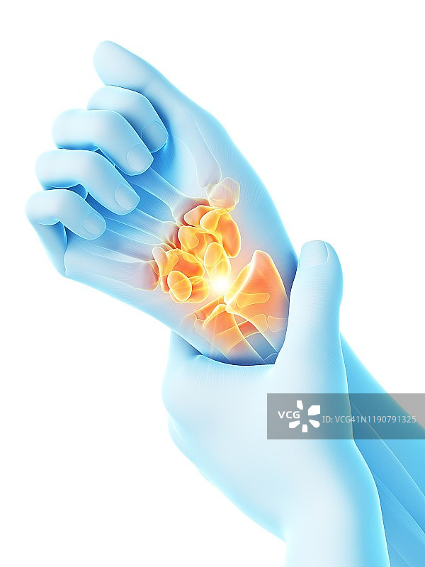 手腕疼痛概念图图片素材