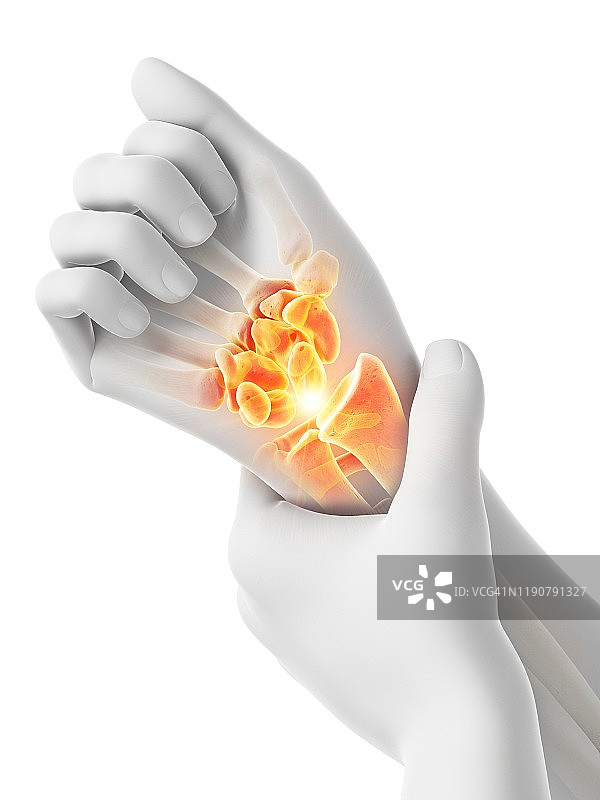 手腕疼痛概念图图片素材