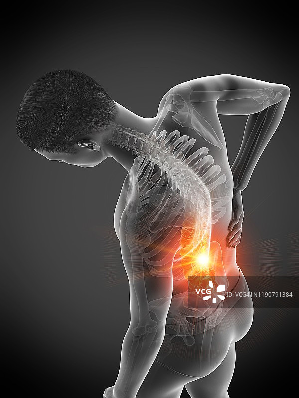 背部疼痛，概念说明图片素材