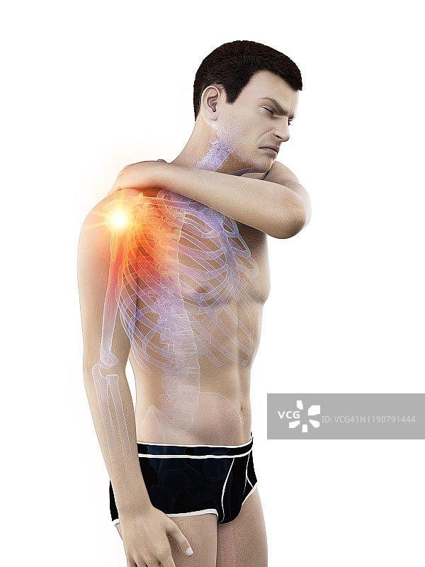 肩痛概念插图图片素材