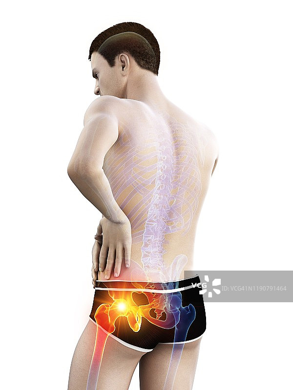 髋部疼痛概念插图图片素材