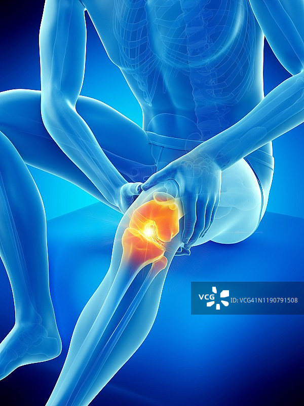 膝盖疼痛概念图图片素材