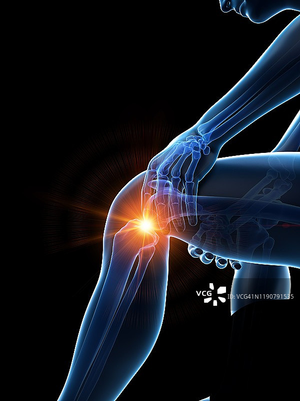 膝盖疼痛概念图图片素材