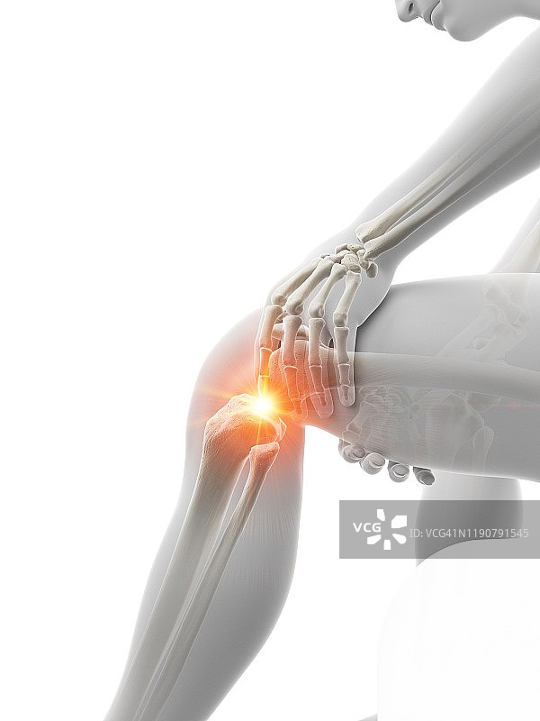 膝盖疼痛概念图图片素材