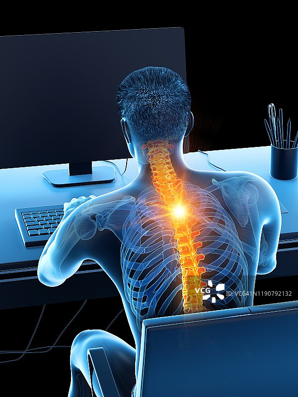 久坐引起的背痛概念插画图片素材