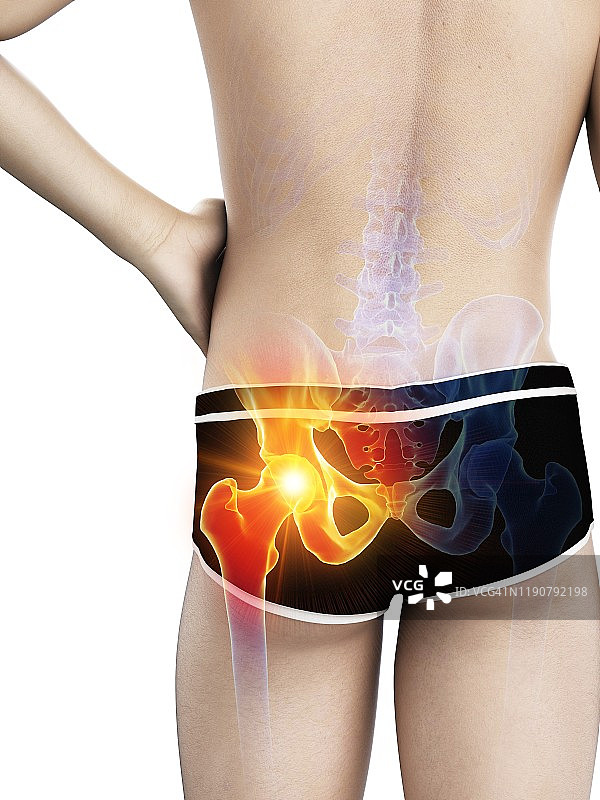髋部疼痛概念插图图片素材