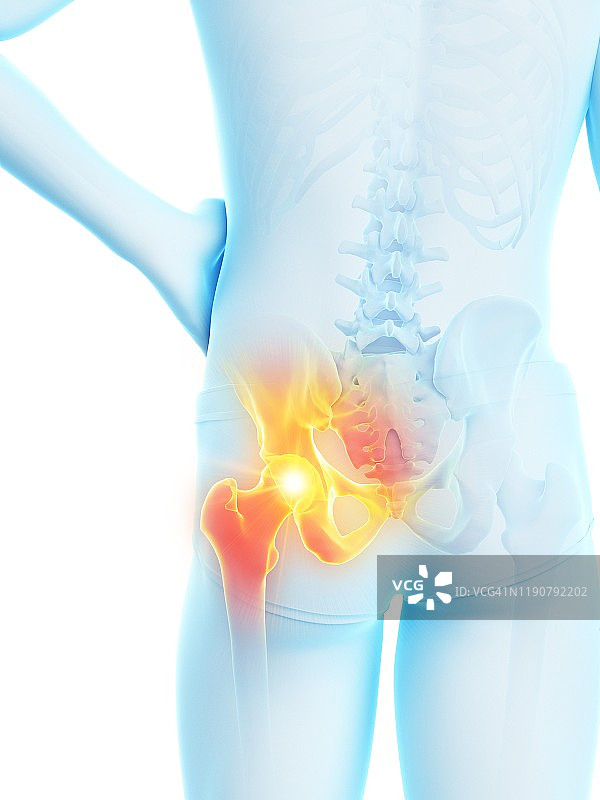 髋部疼痛概念插图图片素材