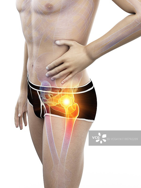 髋部疼痛概念插图图片素材