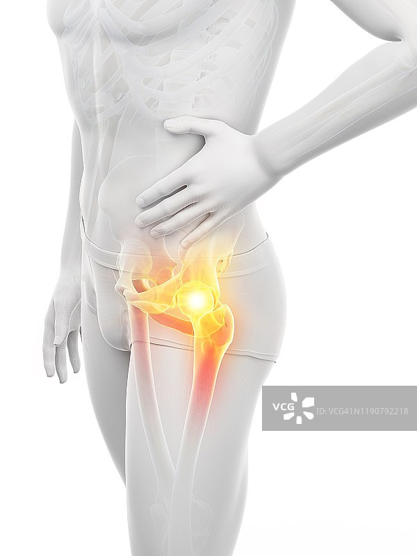 髋部疼痛概念插图图片素材