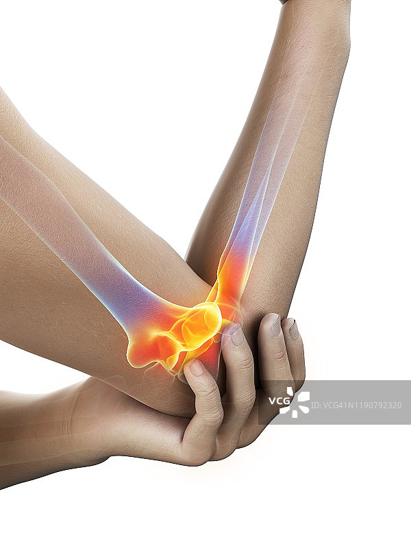 肘部疼痛概念图图片素材