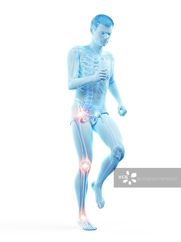 关节疼痛概念图图片素材