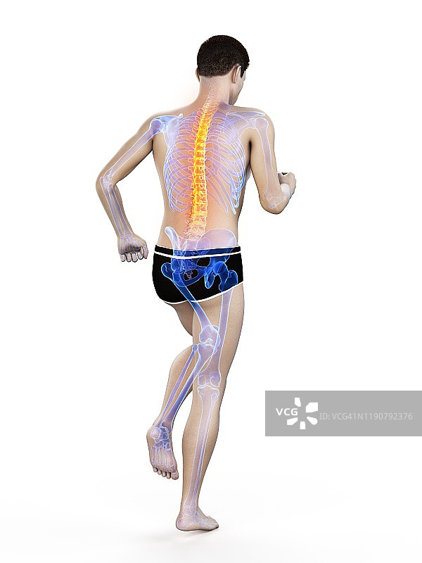 背部疼痛，概念说明图片素材