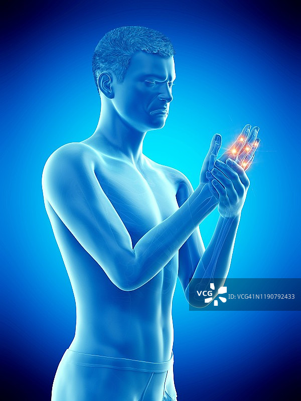 手指疼痛概念图图片素材