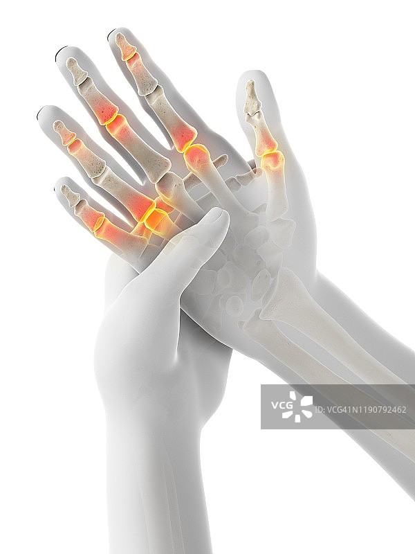 手指疼痛概念图图片素材