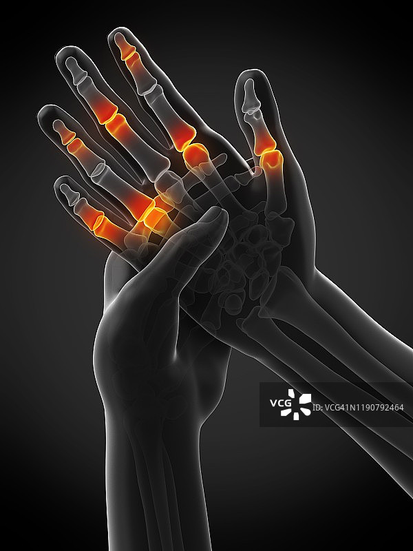 手指疼痛概念图图片素材
