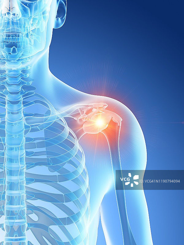 肩痛概念插图图片素材