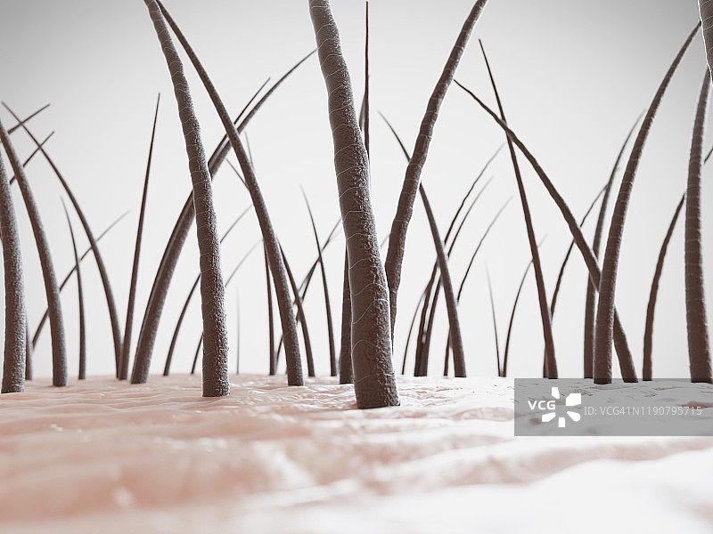 不健康的头发插画图片素材