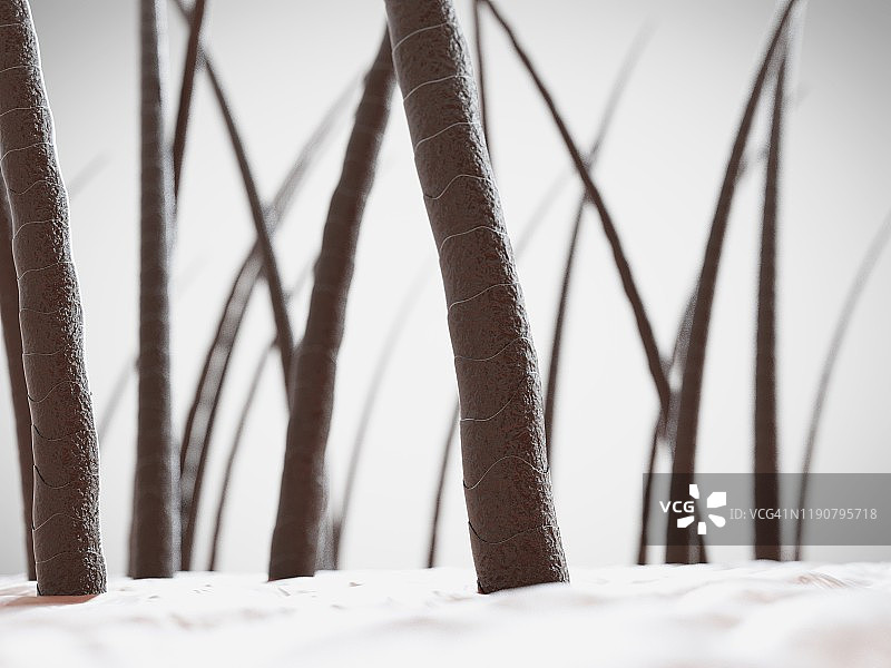 不健康的头发插画图片素材